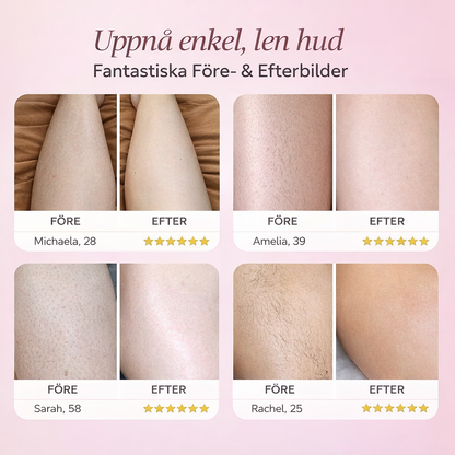 Sōrave Elektrisk Precisionstrimmer